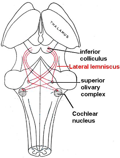 Posterior view of the brainstem showing the lateral lemniscus auditory pathway in red, with cochlear nucleus, superior olive, and inferior colliculus highlighted.