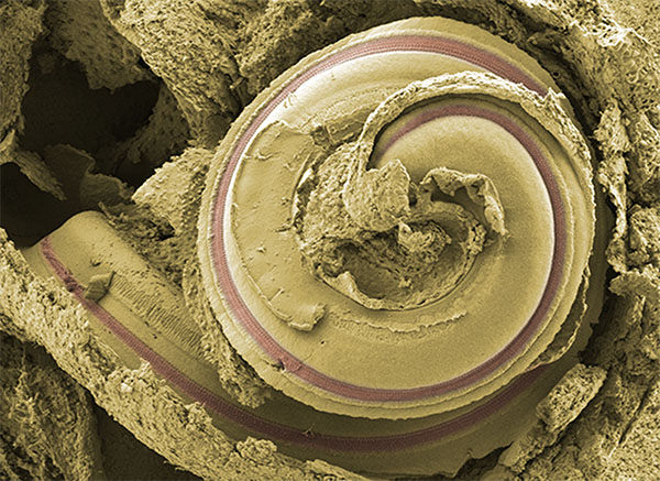 Photograph of a stained mammalian cochlea showing its spiral form.