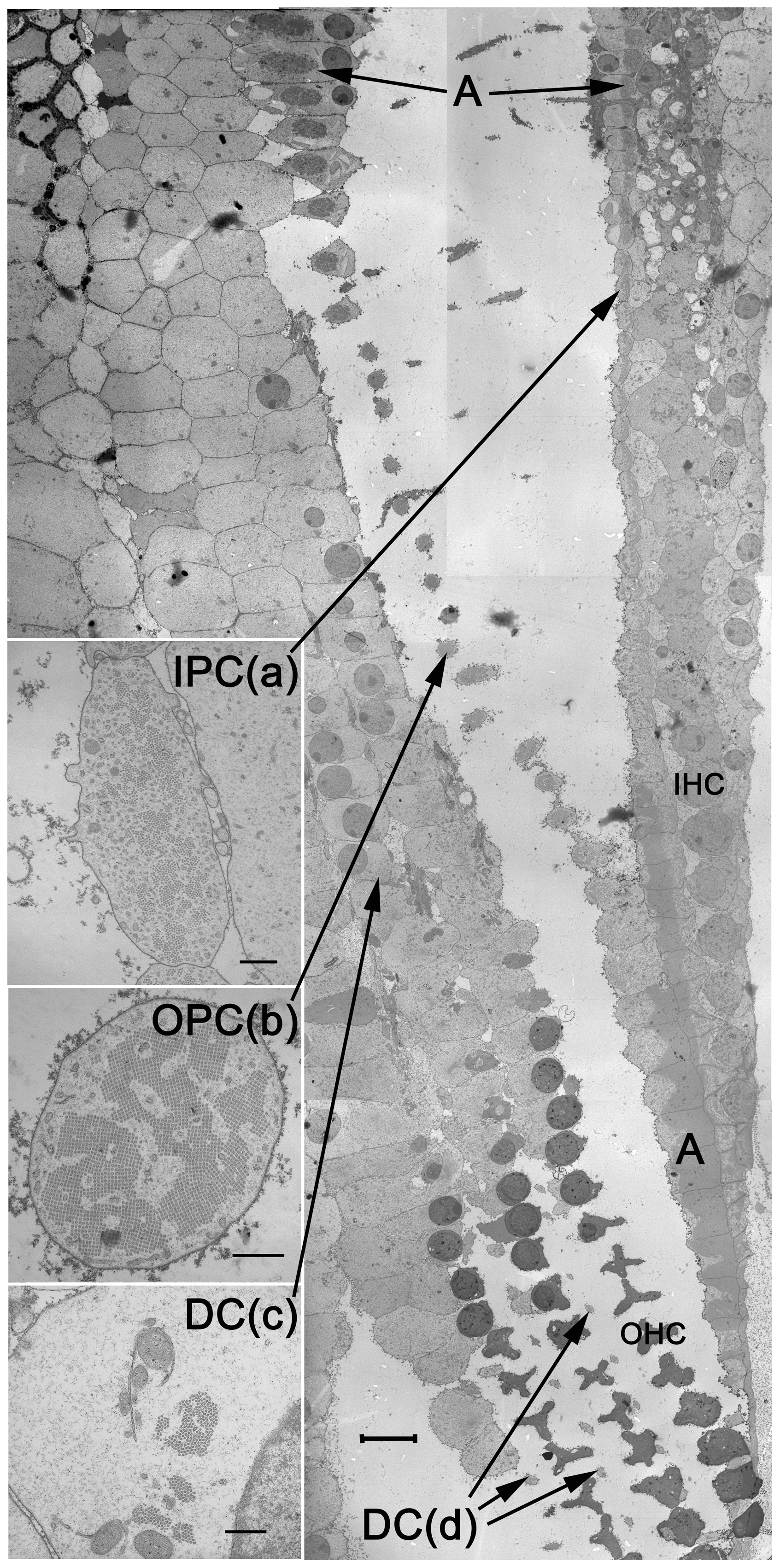 Scanning electron micrograph of the organ of Corti, sectioned at the plane of the basilar membrane.
