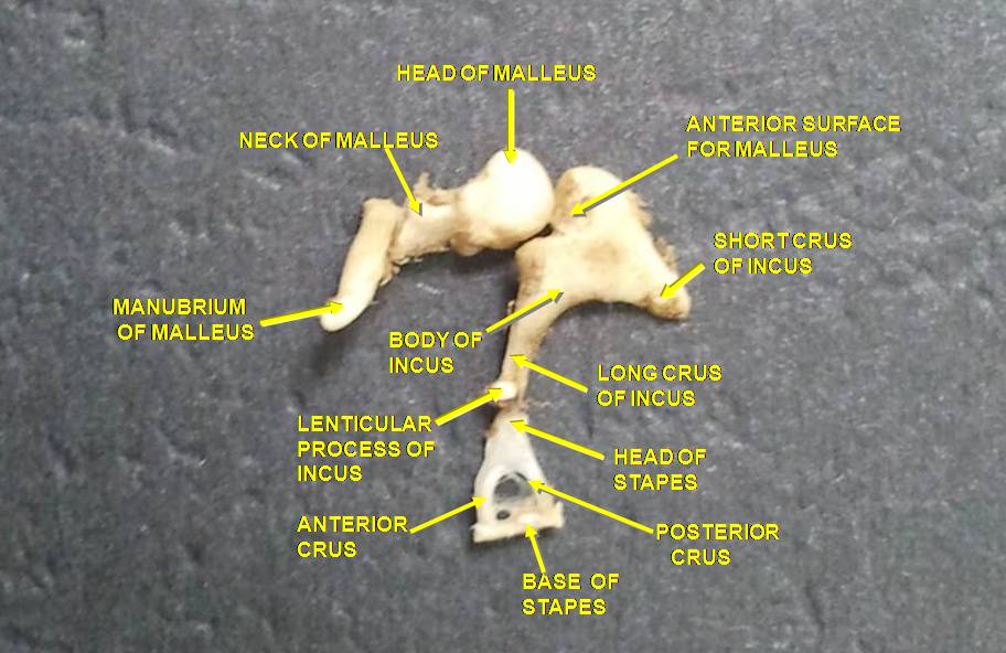 Photograph of the three middle-ear ossicles: malleus, incus, stapes.